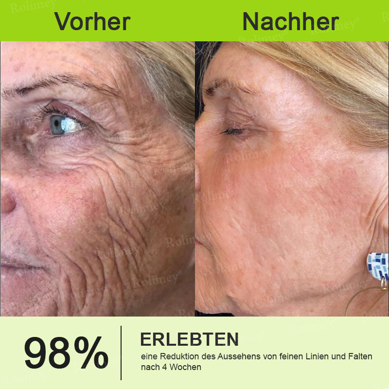 Rolimey® Retinol & Botox Shot -Straffende Gesichtscreme gegen Falten