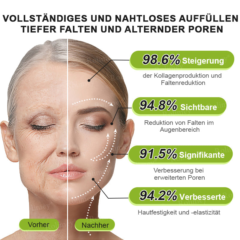 Rolimey® Retinol & Botox Shot -Straffende Gesichtscreme gegen Falten