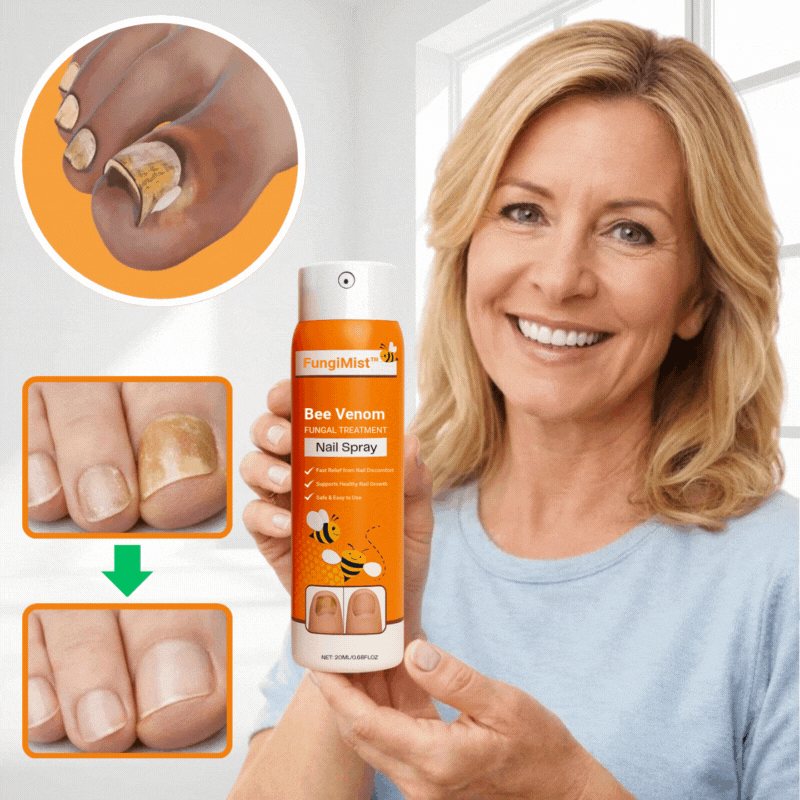 FungiMist™ Anti-Pilz-Spray | Beseitigt 99 % des Nagelpilzes in nur 3 Tagen!