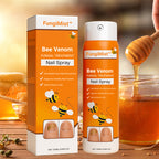 FungiMist™ Anti-Pilz-Spray | Beseitigt 99 % des Nagelpilzes in nur 3 Tagen!