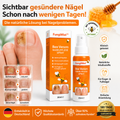 FungiMist™ Anti-Pilz-Spray | Beseitigt 99 % des Nagelpilzes in nur 3 Tagen!