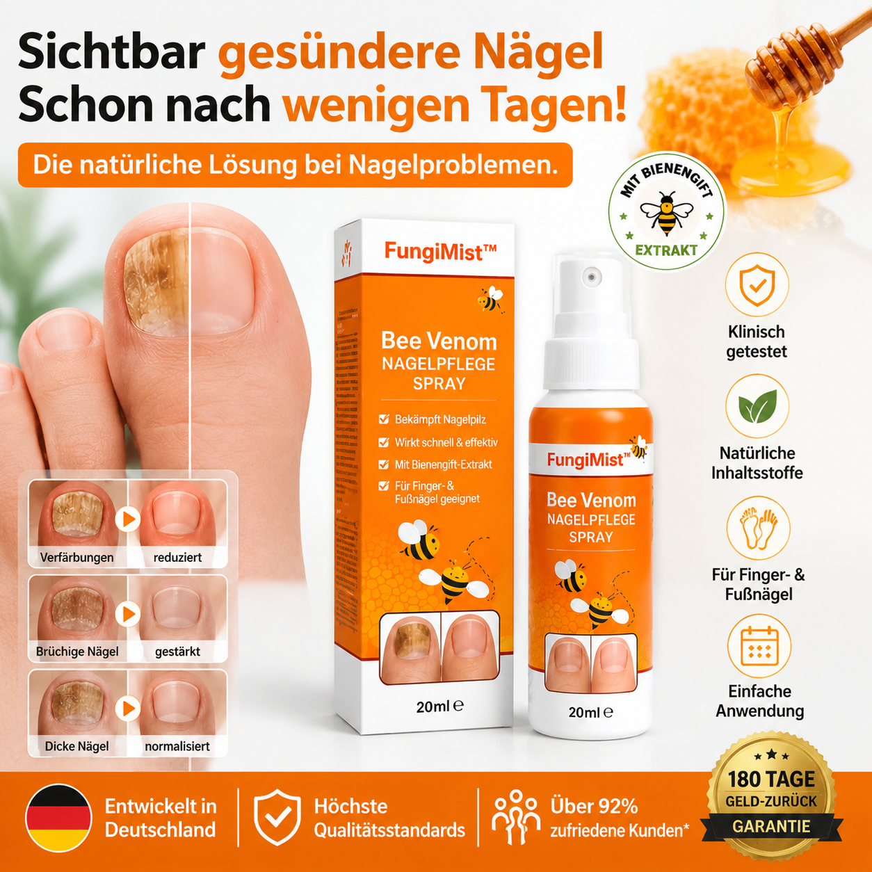 FungiMist™ Anti-Pilz-Spray | Beseitigt 99 % des Nagelpilzes in nur 3 Tagen!