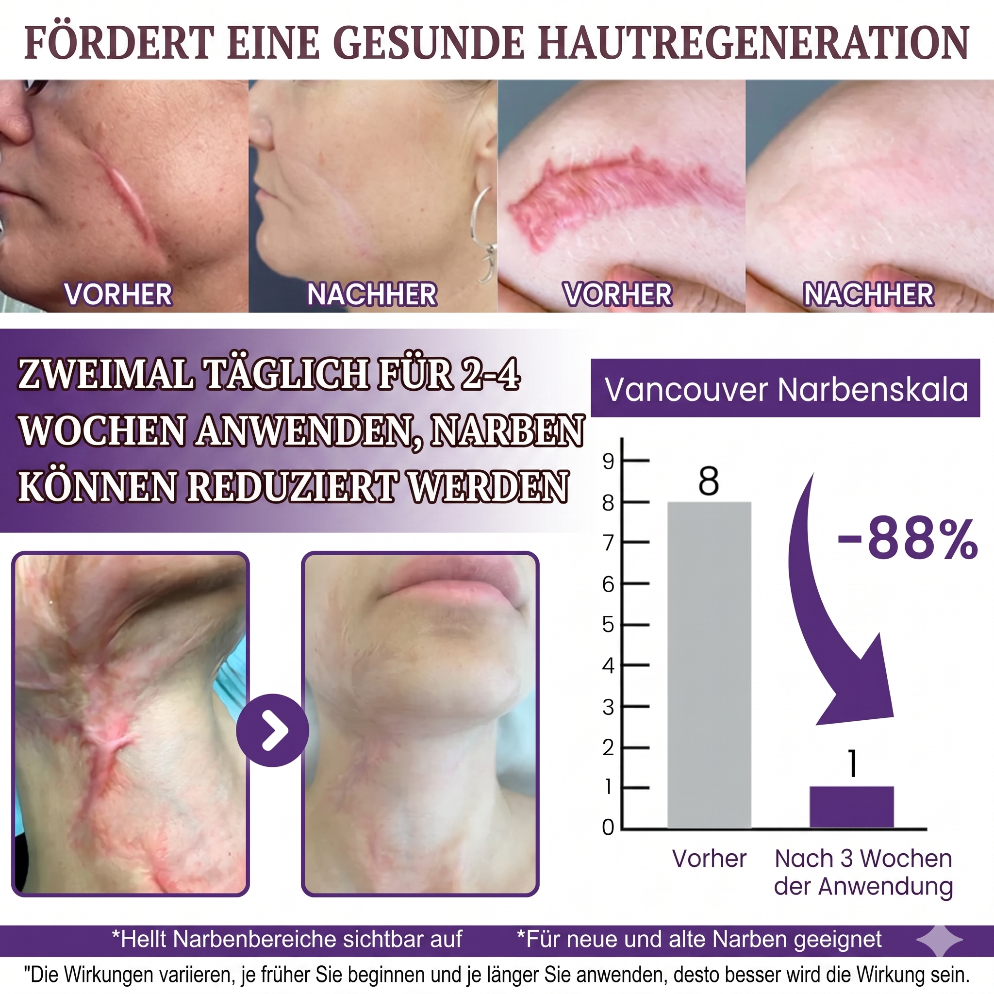 Timilk® REGENSCAR Stammzellen-Narbengel, 20g | Wirksame Narbenpflege – Made in Germany & Klinisch getestet