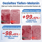 LYW® Niacinamid Tuchmasken zur Hautaufhellung & gegen Pigmentflecken – Original aus Japan