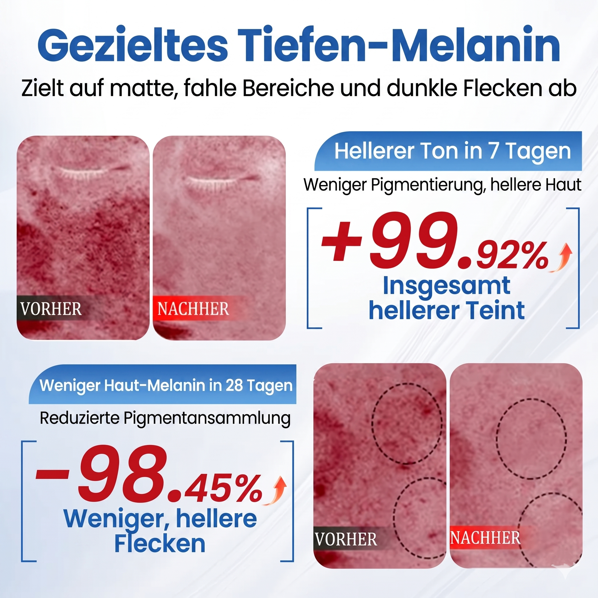 LYW® Niacinamid Tuchmasken zur Hautaufhellung & gegen Pigmentflecken – Original aus Japan