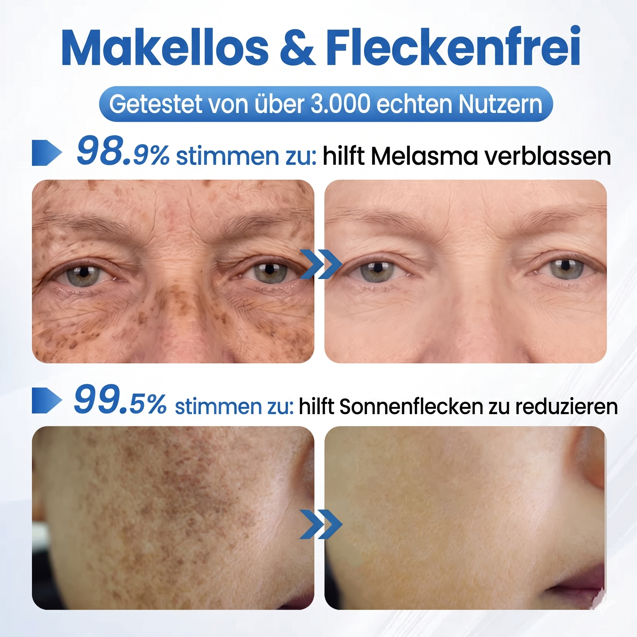 LYW® Niacinamid Tuchmasken zur Hautaufhellung & gegen Pigmentflecken – Original aus Japan