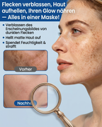 LYW® Niacinamid Tuchmasken zur Hautaufhellung & gegen Pigmentflecken – Original aus Japan