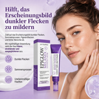 Reduziert das Erscheinungsbild von Sommersprossen und dunklen Flecken für einen strahlenderen, gleichmäßigeren Teint