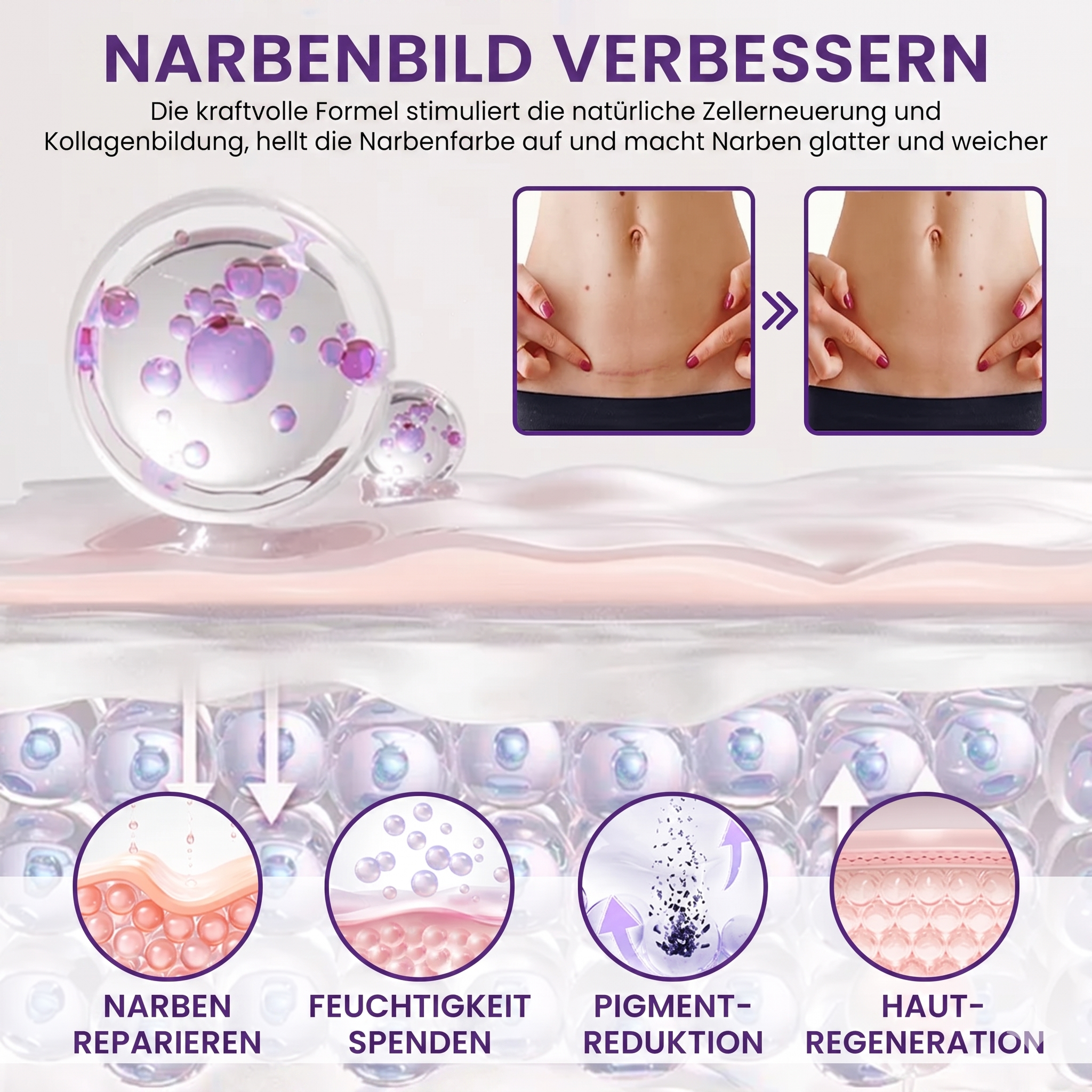 Timilk® REGENSCAR Stammzellen-Narbengel, 20g | Wirksame Narbenpflege – Made in Germany & Klinisch getestet