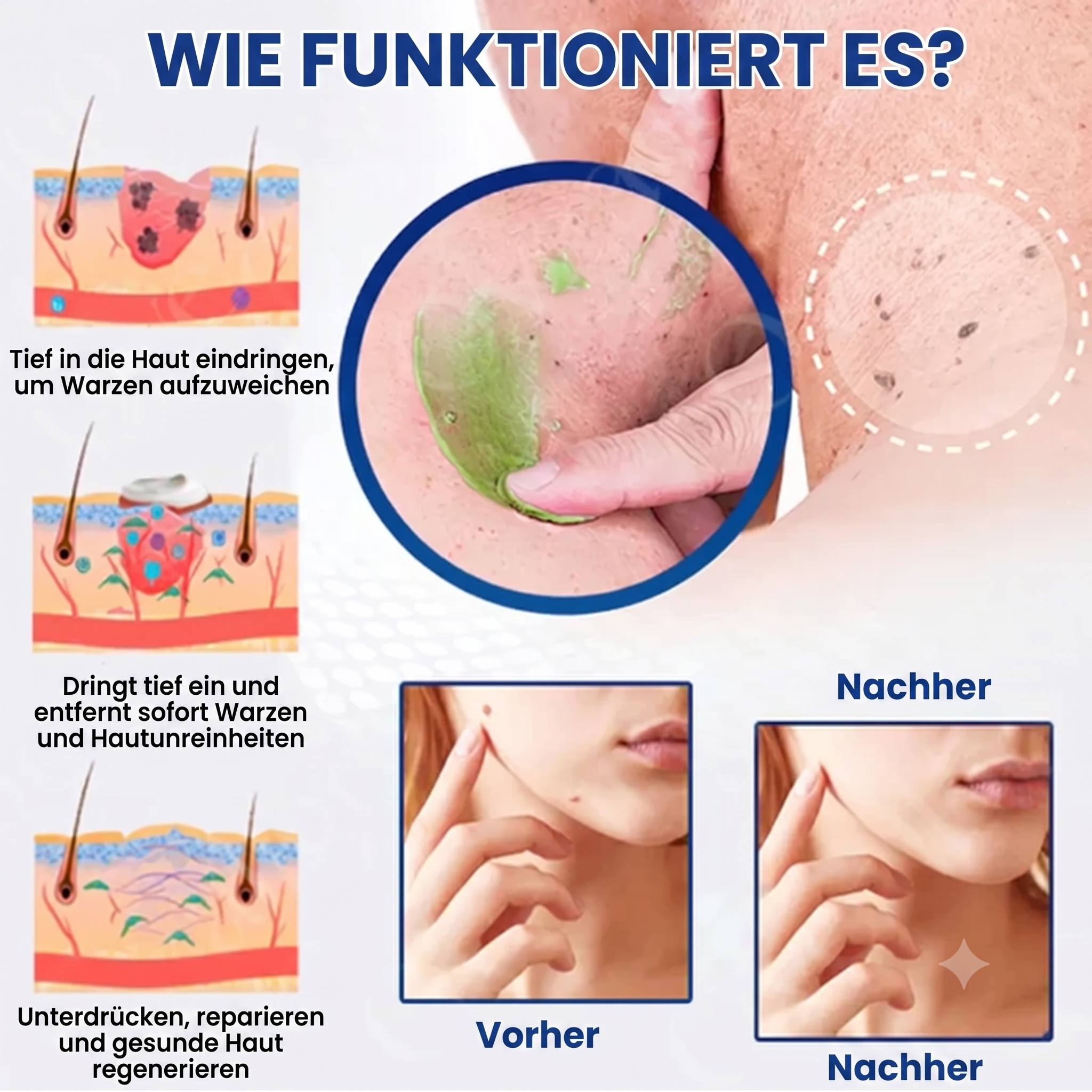 Official Store: Fivfivgo™ NatureErase Instant Mole & Spot Cream | Beseitigt Altersflecken & Muttermale in nur 36 Stunden!