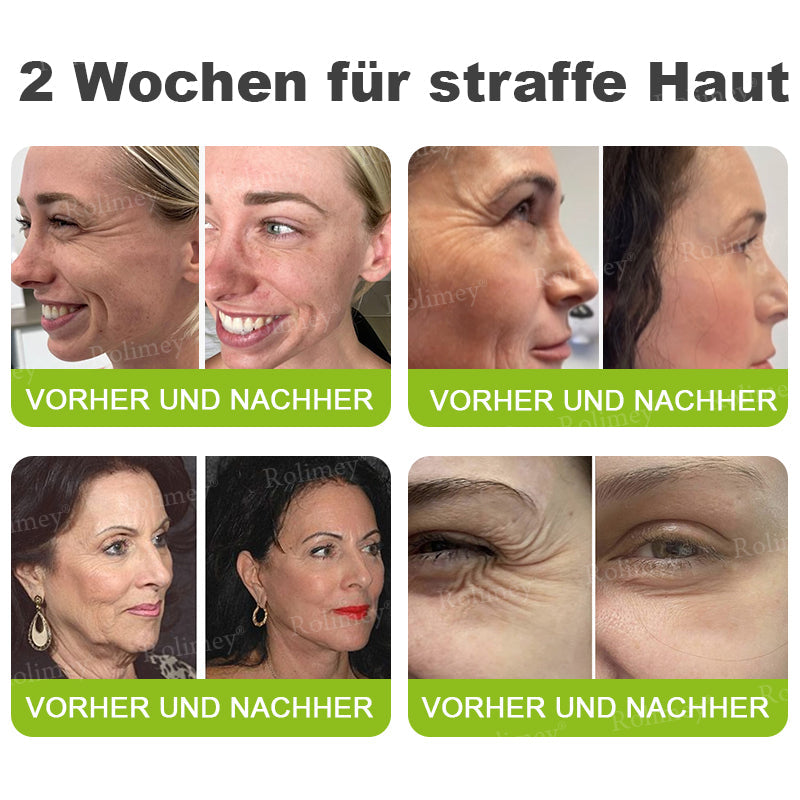 Rolimey® Retinol & Botox Shot -Straffende Gesichtscreme gegen Falten
