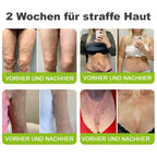 Rolimey® Retinol & Botox Shot -Straffende Gesichtscreme gegen Falten