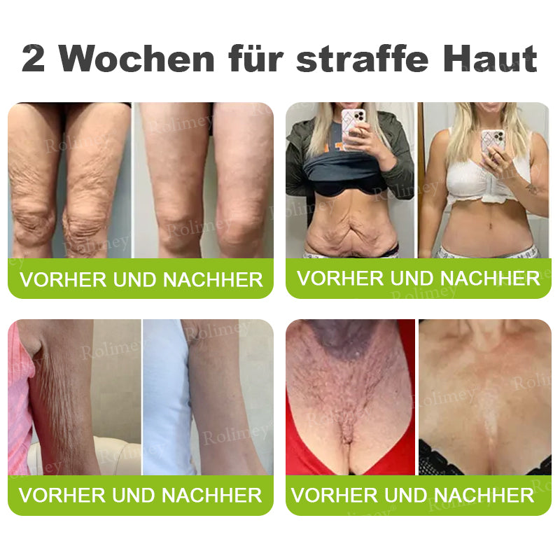 Rolimey® Retinol & Botox Shot -Straffende Gesichtscreme gegen Falten