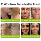 Rolimey® Retinol & Botox Shot -Straffende Gesichtscreme gegen Falten