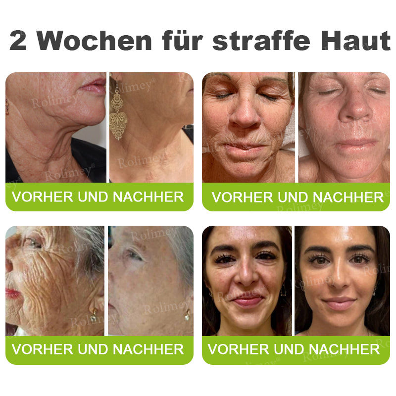 Rolimey® Retinol & Botox Shot -Straffende Gesichtscreme gegen Falten